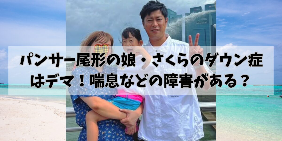 パンサー尾形の娘・さくらのダウン症はデマ！喘息などの障害がある？